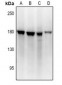 Anti-BMP1 Antibody