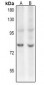 Anti-c-Myb (AcK480) Antibody