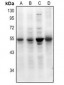 Anti-SMAD7 (AcK70) Antibody