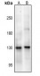 Anti-NMDAR1 (pS890) Antibody