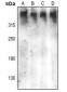 Anti-DNA-PKcs (pS2612) Antibody