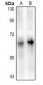 Anti-DAB1 (pY220) Antibody