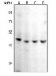 Anti-CD142 Antibody