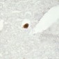 Anti-DGK zeta Antibody