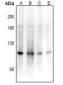 Anti-ADAMTS17 Antibody