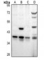 Anti-RALY Antibody