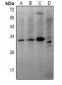 Anti-THOC4 Antibody