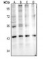 Anti-IL-11RA Antibody