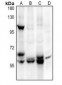 Anti-ALPL Antibody