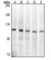 Anti-Topoisomerase 1 Antibody