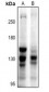 Anti-BUB1 Antibody