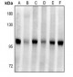 Anti-Plasminogen Antibody