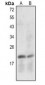 Anti-Caspase 7 p20 Antibody