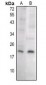 Anti-Caspase 8 p18 Antibody