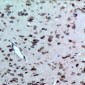 Anti-CD363 Antibody