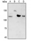 Anti-Beta Amyloid Antibody