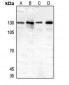 Anti-Thrombospondin 4 Antibody