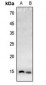 Anti-Histone H4 (AcK20) Antibody