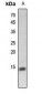 Anti-Histone H2A (Butyryl-K5) Antibody