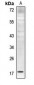 Anti-Histone H4 (MonoMethyl-K5) Antibody