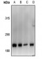 Anti-Von Willebrand Factor Antibody