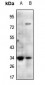 Anti-Mimecan Antibody