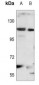 Anti-STAT2 Antibody