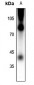 Anti-Rhodopsin (pS334) Antibody