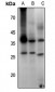 Anti-Aquaporin 2 (pS256) Antibody