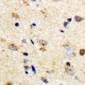 Anti-CD4 (pS433) Antibody