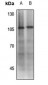 Anti-MDM2 (pS186/S188) Antibody