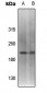Anti-Topoisomerase 2 alpha (pS1213) Antibody