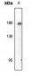 Anti-EGFR (pY869) Antibody