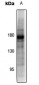 Anti-PDGFR beta (pY857) Antibody