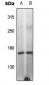Anti-DAP Kinase 1 (pS308) Antibody