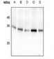 Anti-14-3-3 sigma (pS186) Antibody