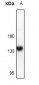 Anti-CD117 Antibody