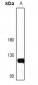 Anti-NFAT1 Antibody