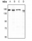 Anti-CD49d Antibody