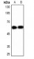 Anti-YBX1 Antibody
