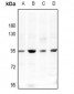 Anti-CD113 Antibody