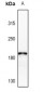 Anti-Collagen 4 alpha 2 Antibody