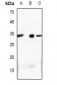 Anti-Complement C1S LC Antibody
