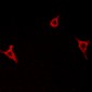 Anti-GPR146 Antibody