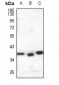 Anti-GPR146 Antibody