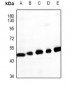 Anti-GPR62 Antibody