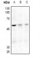 Anti-ACVR2A Antibody