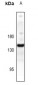 Anti-CD49e Antibody