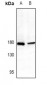 Anti-CD339 Antibody