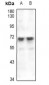 Anti-EAAT2 Antibody